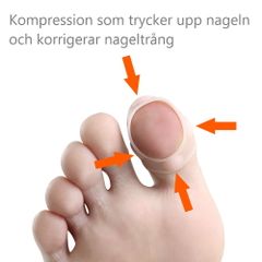 Nageltrång korrigerande silikonskydd för stortå 2st