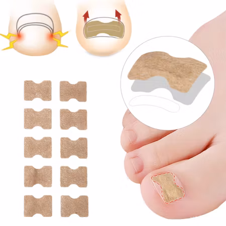 Nageltrång korrigerande nageltejp