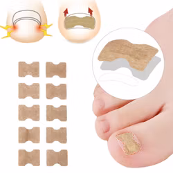 Nageltrång korrigerande nageltejp