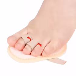 Hammartå stabiliserande förfotsstöd