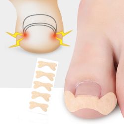 Nageltrångstejp