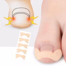 Nageltrångstejp
