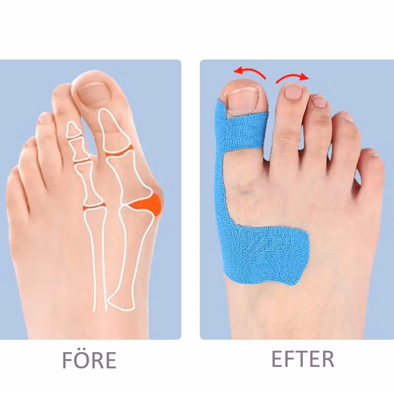 Kinesiotejp hallux valgus 10st , färdigskuren BEIGE
