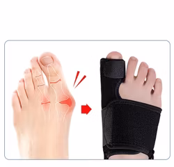 Hallux valgus korrigerande stödskena med justerbart band 1st