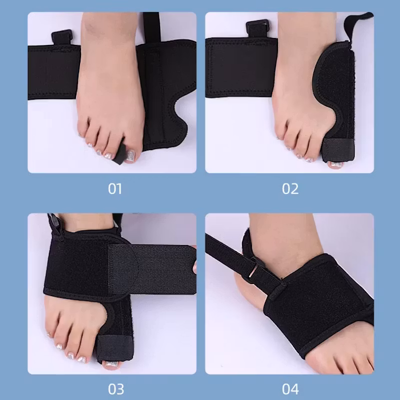 Hallux valgus korrigerande stödskena med justerbart band 1st