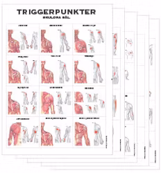 Triggerpunkter 50x70 cm, 5 planscher
