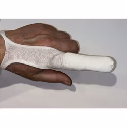 FingerDerm