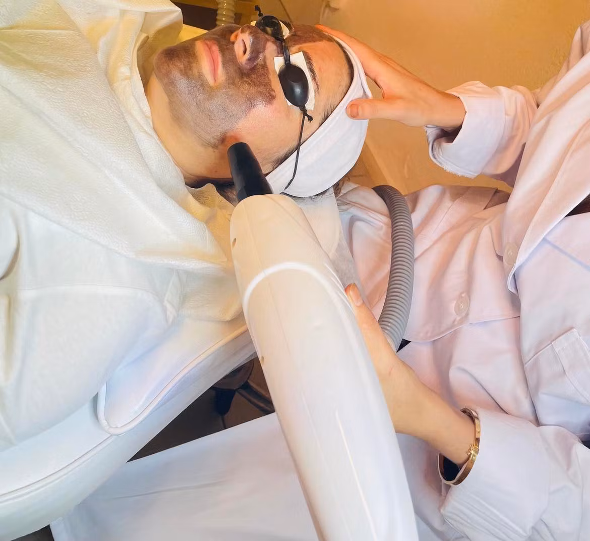 Karbon peeling kurs + tattoo bortagning