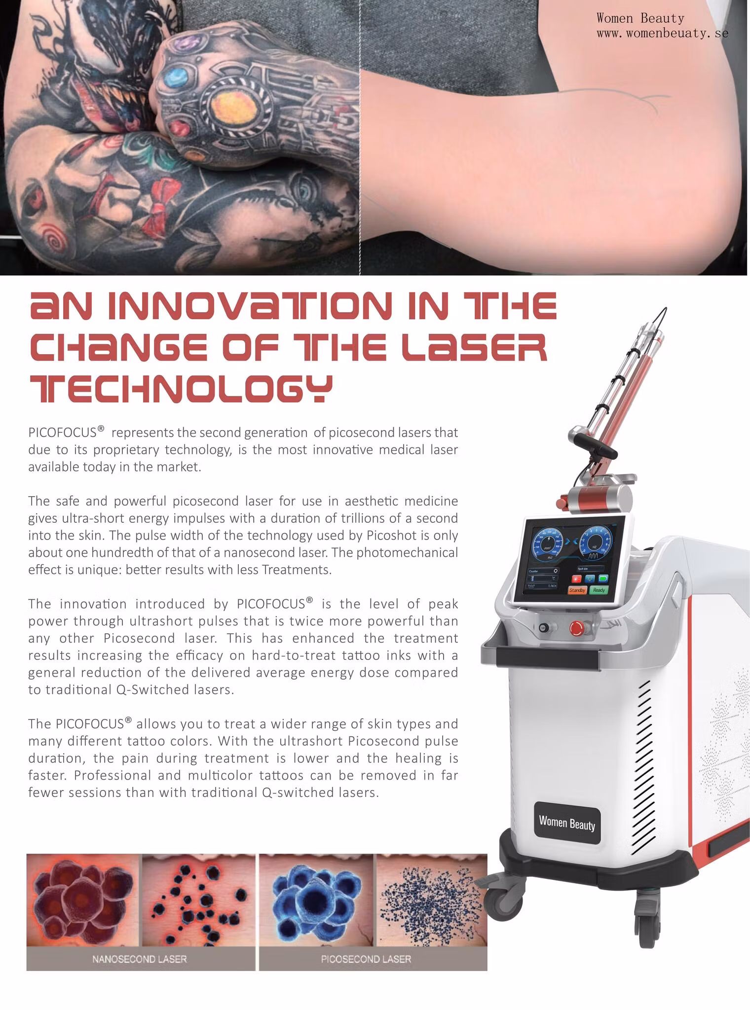 laser and nd yag laser/ fråga om offert