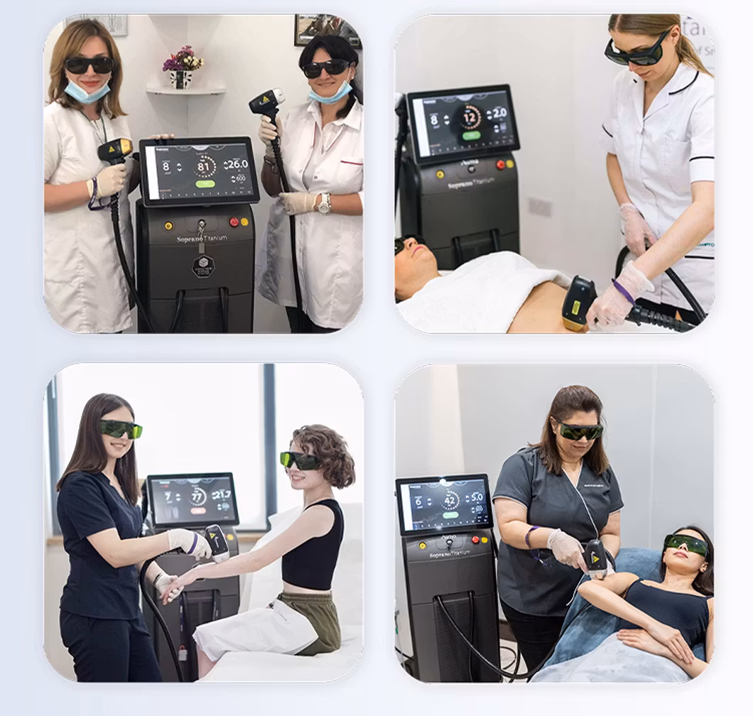 808nm Diode Laser Hair Removal Machine