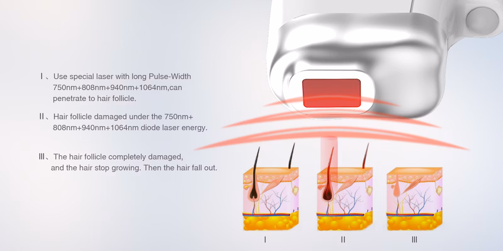 2000 w super smart laser maskin