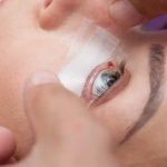 Micropore tape