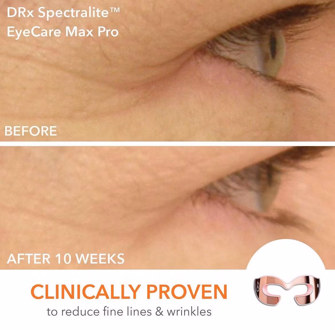 DRx Spectralite Eyecare Pro