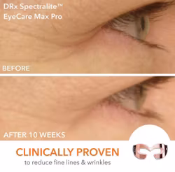 DRx Spectralite Eyecare Pro