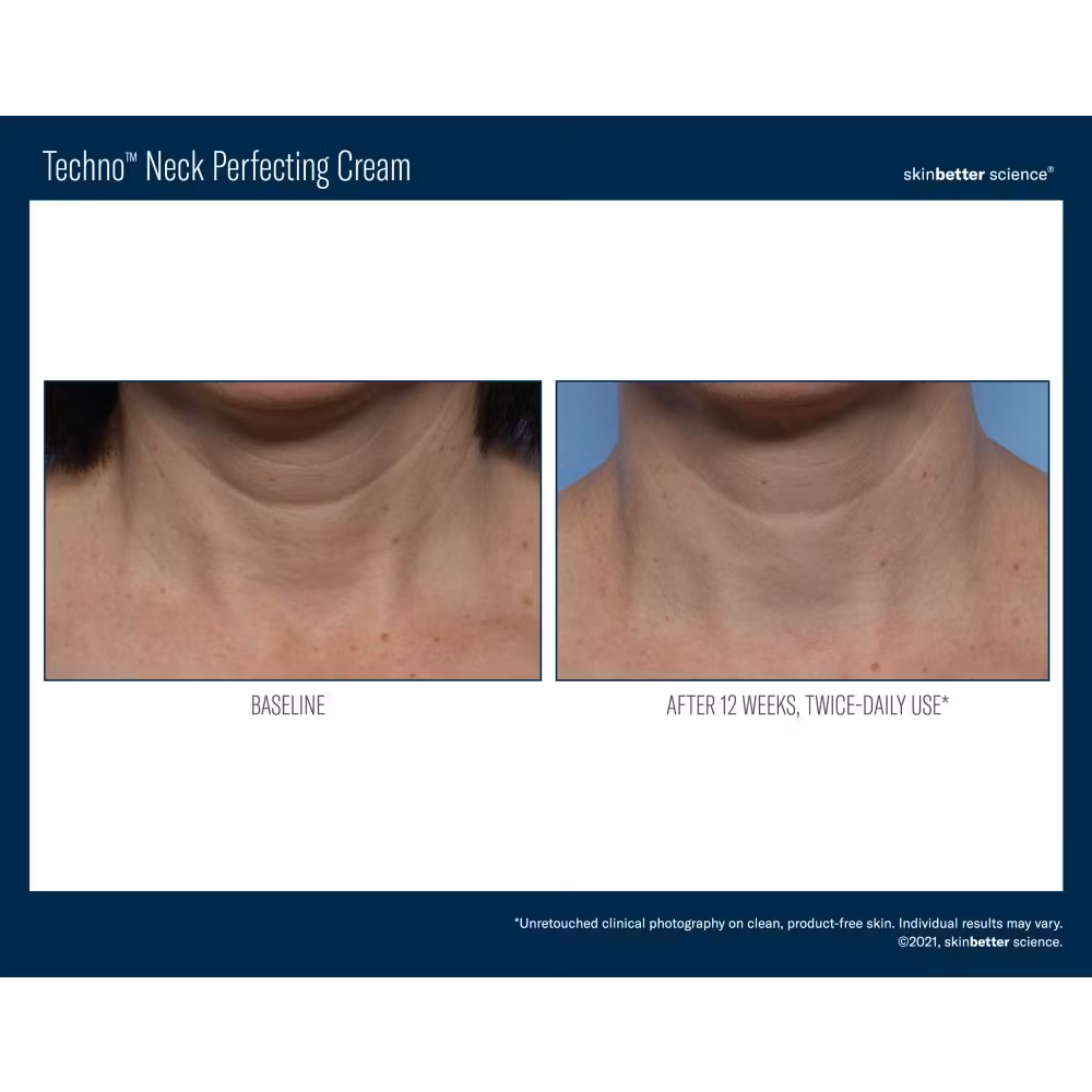 Techno Neck Perfecting Cream 50 ml