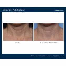 Techno Neck Perfecting Cream 50 ml