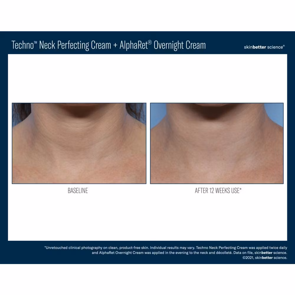 Techno Neck Perfecting Cream 50 ml