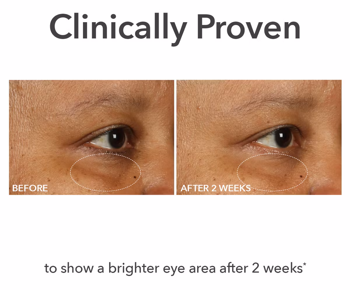Fill+Repair Eye cream
