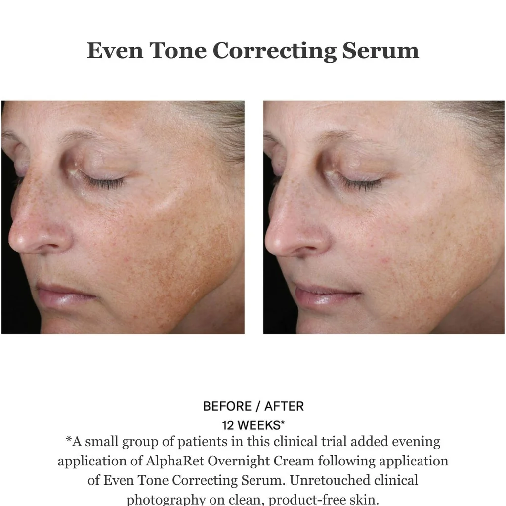Even Tone Correcting Serum FACE 50ml