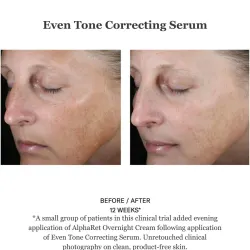 Even Tone Correcting Serum FACE 50ml