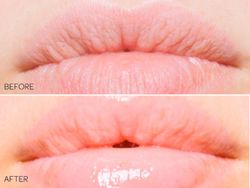 Lipsmart