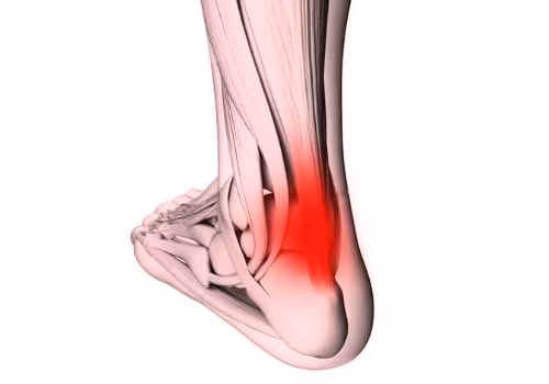 Hälseneinflammation - Rehab Prylar