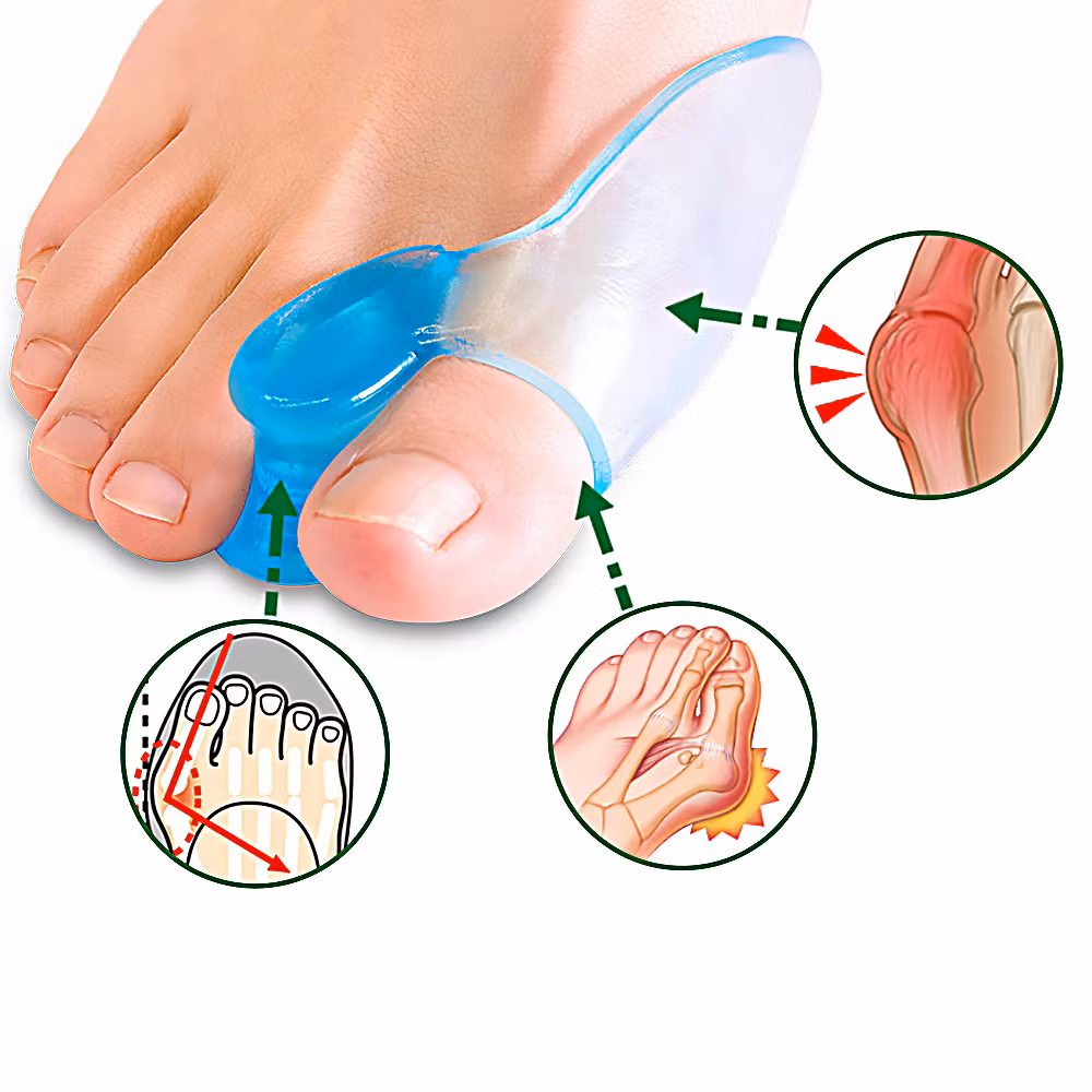 Tå separerare - Korrigerar sneda tår och förebygger hallux valgus