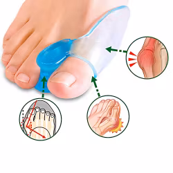 Tå separerare - Korrigerar sneda tår och förebygger hallux valgus