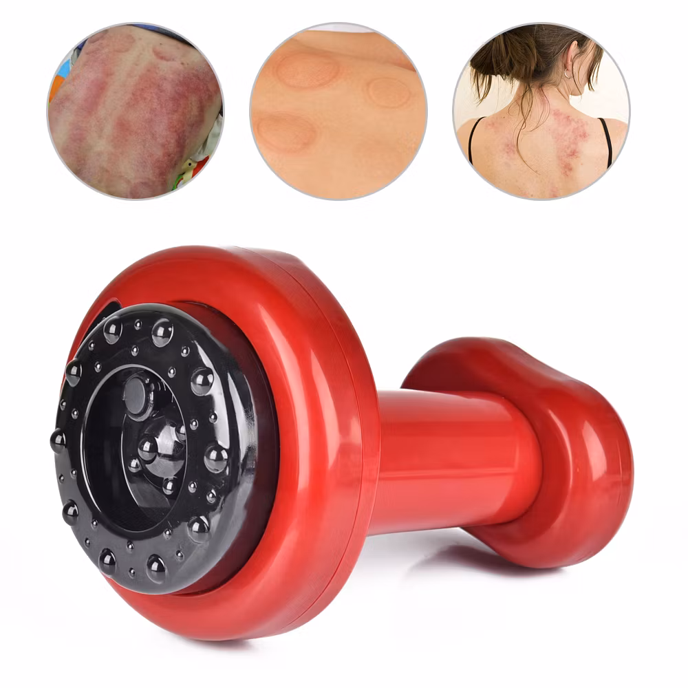 ThermoCupp – Elektrisk Koppning och Gua Sha Terapi