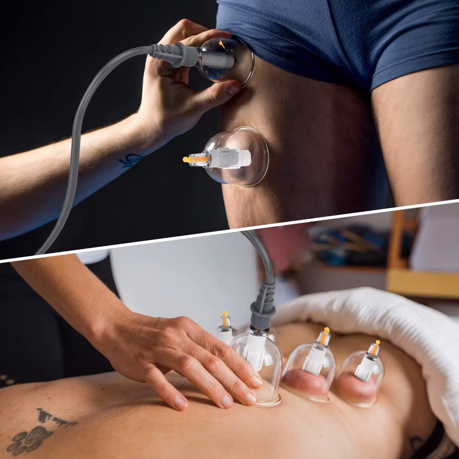 Koppningskit med Sugkoppor – Mot Smärta, Spänningar & Celluliter