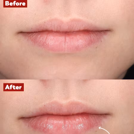 Plump Lip TREW