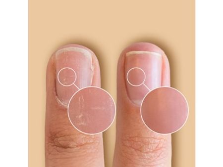 SolarOil Nail Care 7,38 ml