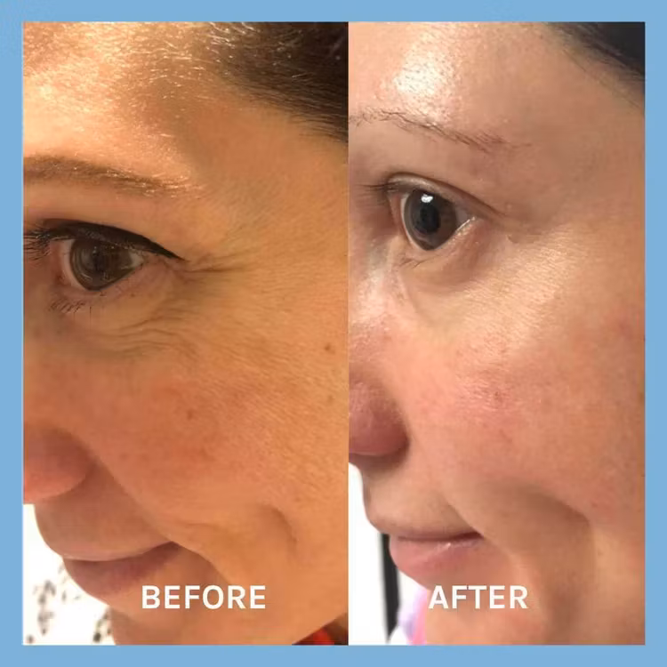 Evolve Organic Age Defying Lifting Serum