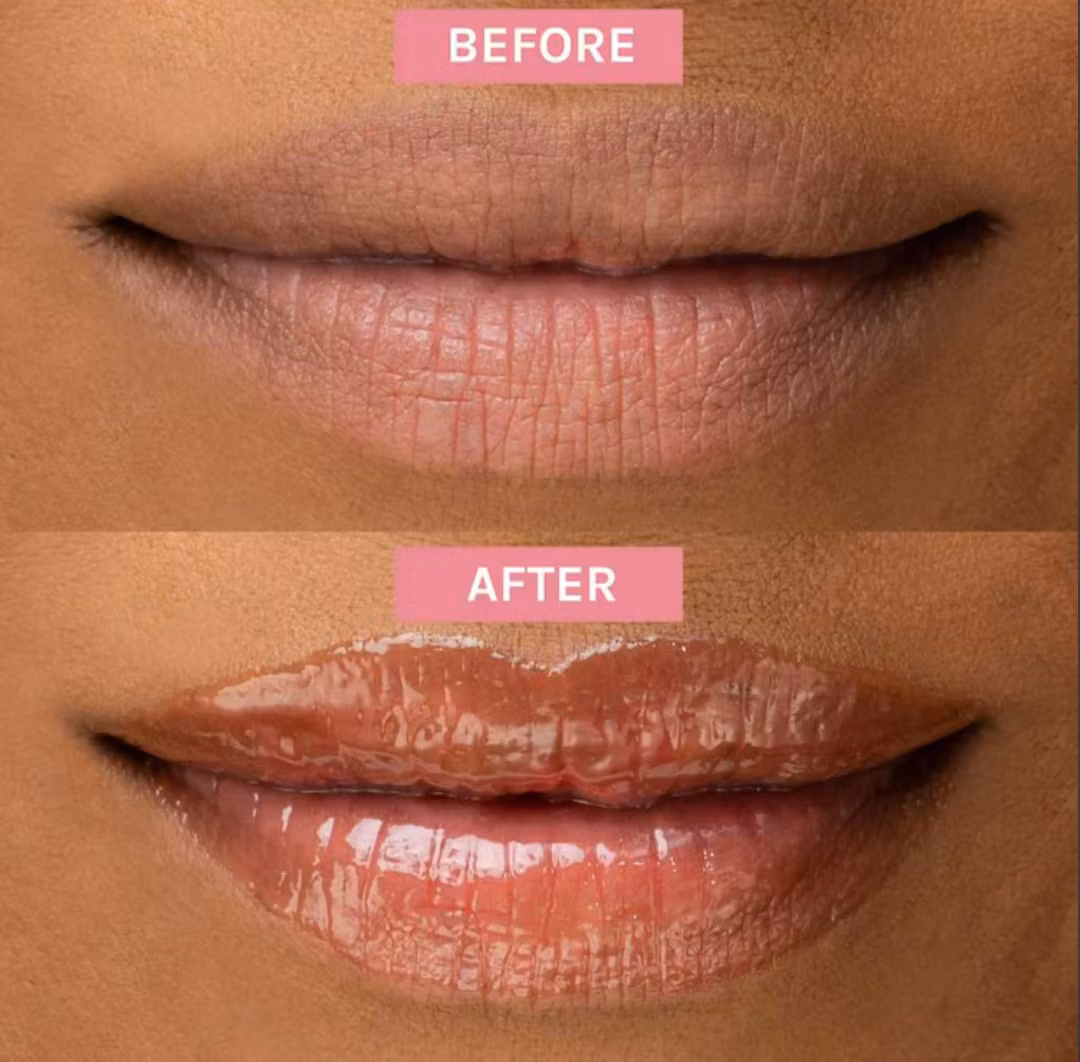 Evolve Bio-Retinol Glossy Lip Oil 15ml