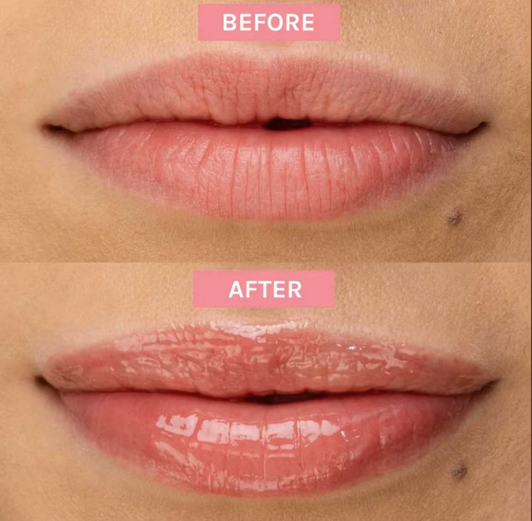 Evolve Bio-Retinol Glossy Lip Oil 15ml
