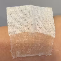 WoundClot Trauma hemostatisk gasväv