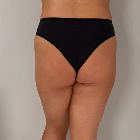 Hög Brazilian Trosa
