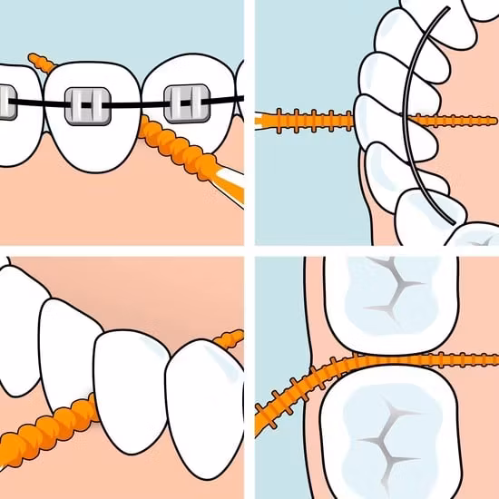 TePe EasyPick XS/S Orange 36 st