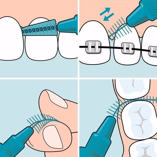 TePe EasyFit S/M 6 st