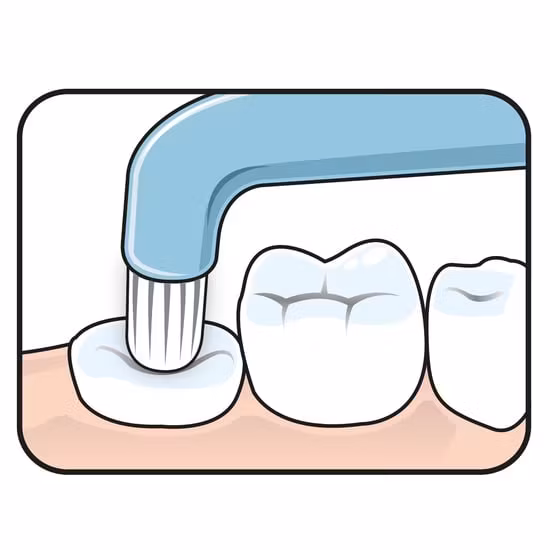 TePe Compact Tuft Vinkelborste 1 st