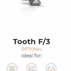 Tooth type F/3