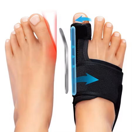 Komfortabel tåstöd hallux valgus