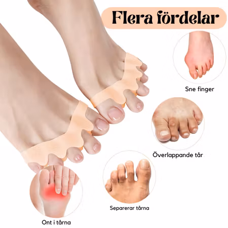 Tåseparerare Hallux Valgus (2st)