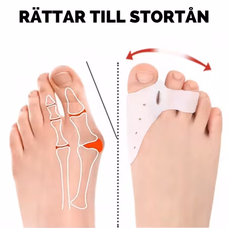 Stortåseparerare (2st)