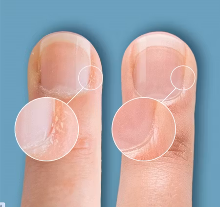 Cuticle Eraser