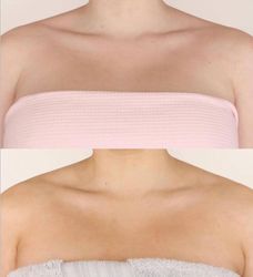 Winter Skin