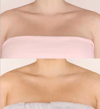 Winter Skin