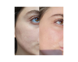 Serum of Clear