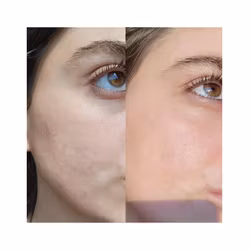 Serum of Clear