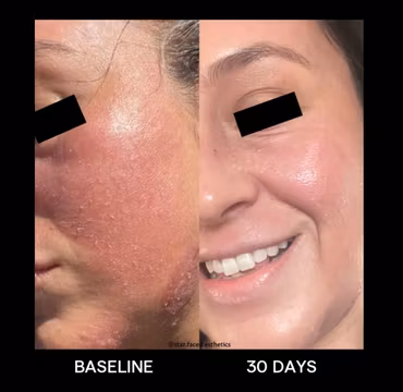 Biome Balancing Serum